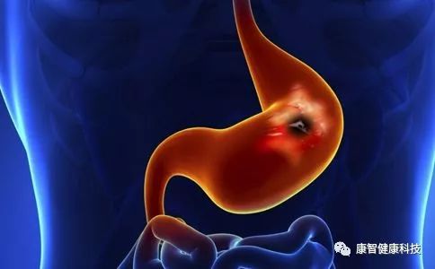 胃病是人人都有不知道怎么治,好多胃病是治不彻底吗
