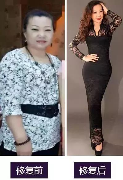 美体塑形衣轻松身材管理,美速健康修复内衣