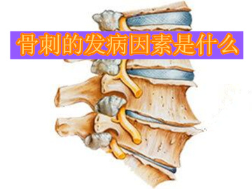 哪些因素会增加骨刺的发病几率
