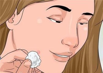 你知道什么叫痘印吗,成人痘是什么意思