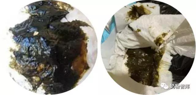 宝宝拉绿便最常见的10种原因,宝宝绿便11种改善方式