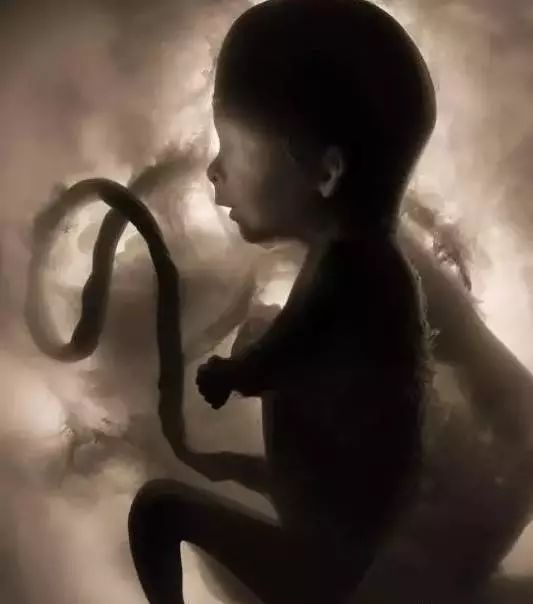 月安馨小课堂“羊水”为什么叫羊水呢?