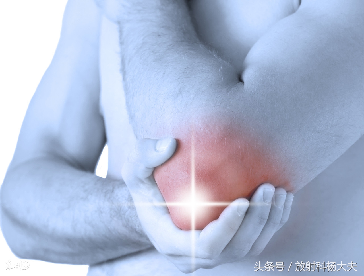 骨肉瘤是罕见病,和骨肉瘤相似的病