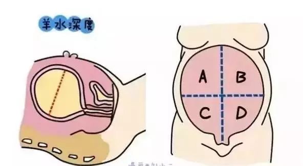 月安馨小课堂“羊水”为什么叫羊水呢?