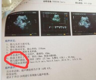 孕期B超单透露的重要信息！教你看懂9大关键指标