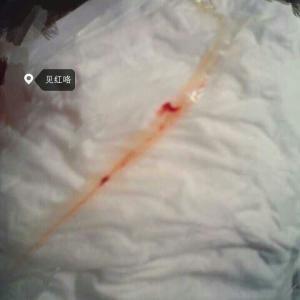 生前见红是什么颜色,见红一般是什么颜色图片