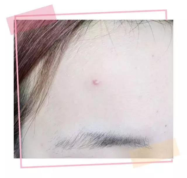 最强遮瑕黑眼圈,最强遮斑遮瑕