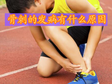 骨刺的发病与什么原因有关系
