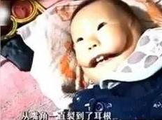 孕妇生下怪胎的孩子,孕妇生出畸形孩童