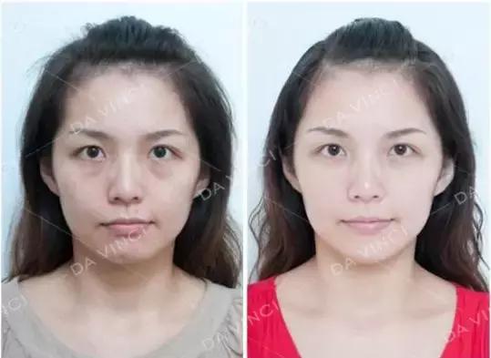 “隔夜脸”丧丧的？最有效补水方式，看这里！