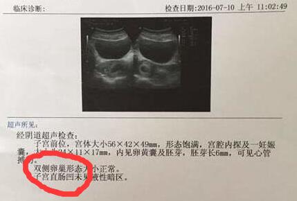 孕期B超单透露的重要信息！教你看懂9大关键指标