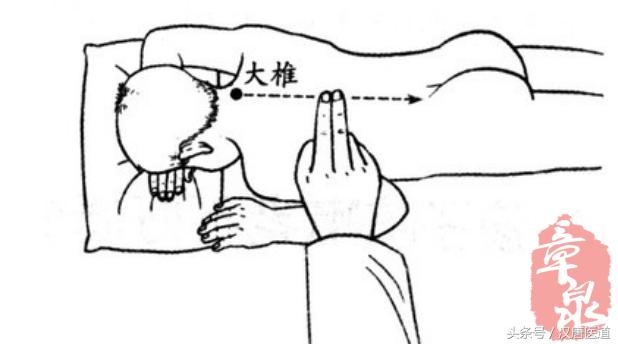 流感病毒反复发热什么原因,流感持续高烧精神正常