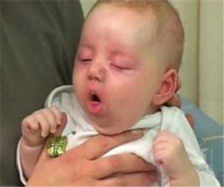 宝宝一直故意咳嗽,宝宝一直咳嗽是怎么回事