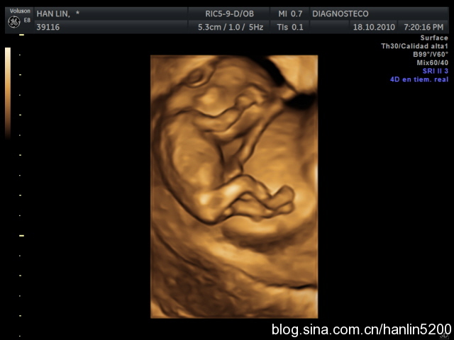 准妈妈看过来孕期瑜伽,孕期b超知识大全