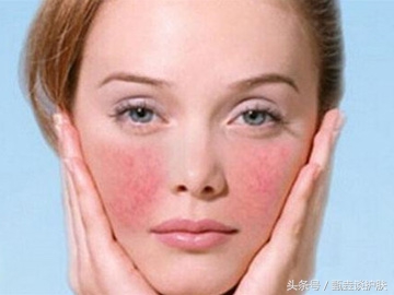 怎么修复红血丝敏感肌肤,修复敏感红血丝的方法