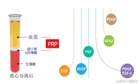 prp面部抗衰真的有效果吗,prp面部抗衰到底有没有效果