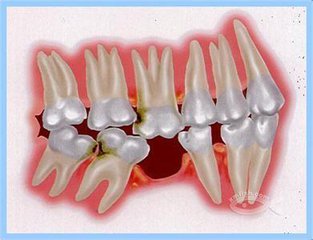 矫正牙齿医院贵还是牙科诊所贵,牙科诊所贵还是医院贵