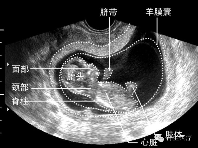 准妈妈看过来孕期瑜伽,孕期b超知识大全