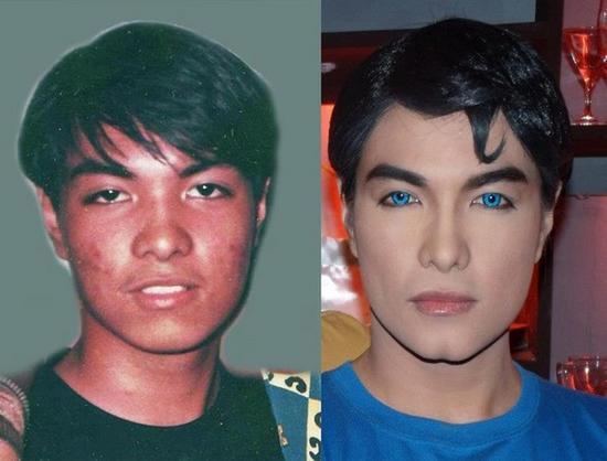 男子整容变超人,男子被迫做整容手术变成女性