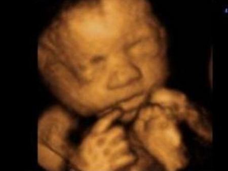 准妈妈看过来孕期瑜伽,孕期b超知识大全