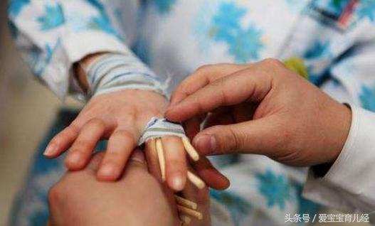 妈妈一时疏忽大意，导致4岁男童3根手指“骨折”！