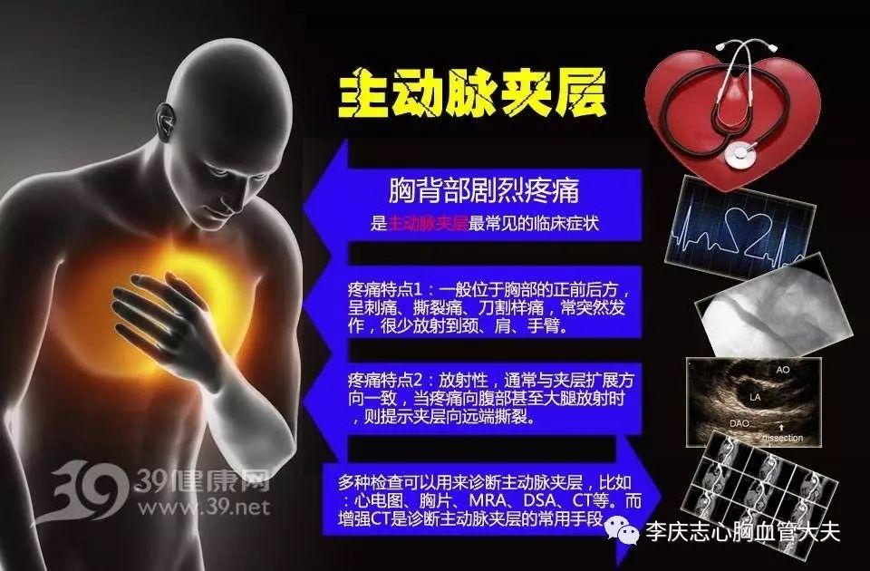 最常引起胸痛的是哪种肺癌,常见致命性胸痛有哪些