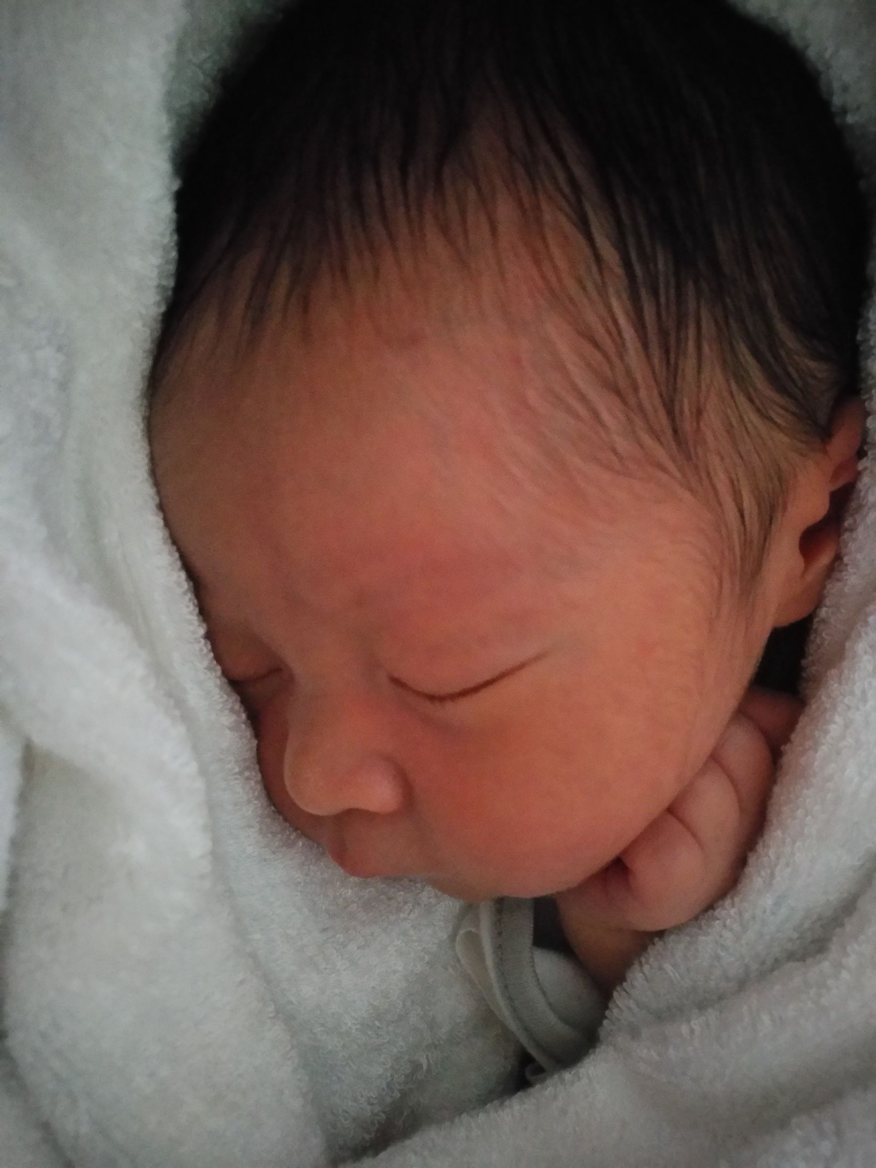 头胎顺产记录,顺产催产记录表