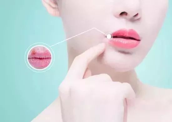 一块钱的红霉素软膏有什么功效,红霉素软膏为啥这么便宜