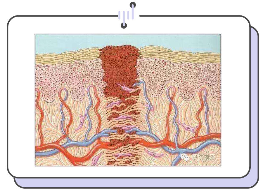手把手教你正确挤痘不留坑,挤痘挤了个坑