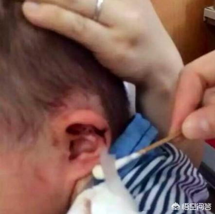 小孩耳朵里有东西出不来怎么办,宝宝耳朵有异物是怎么回事