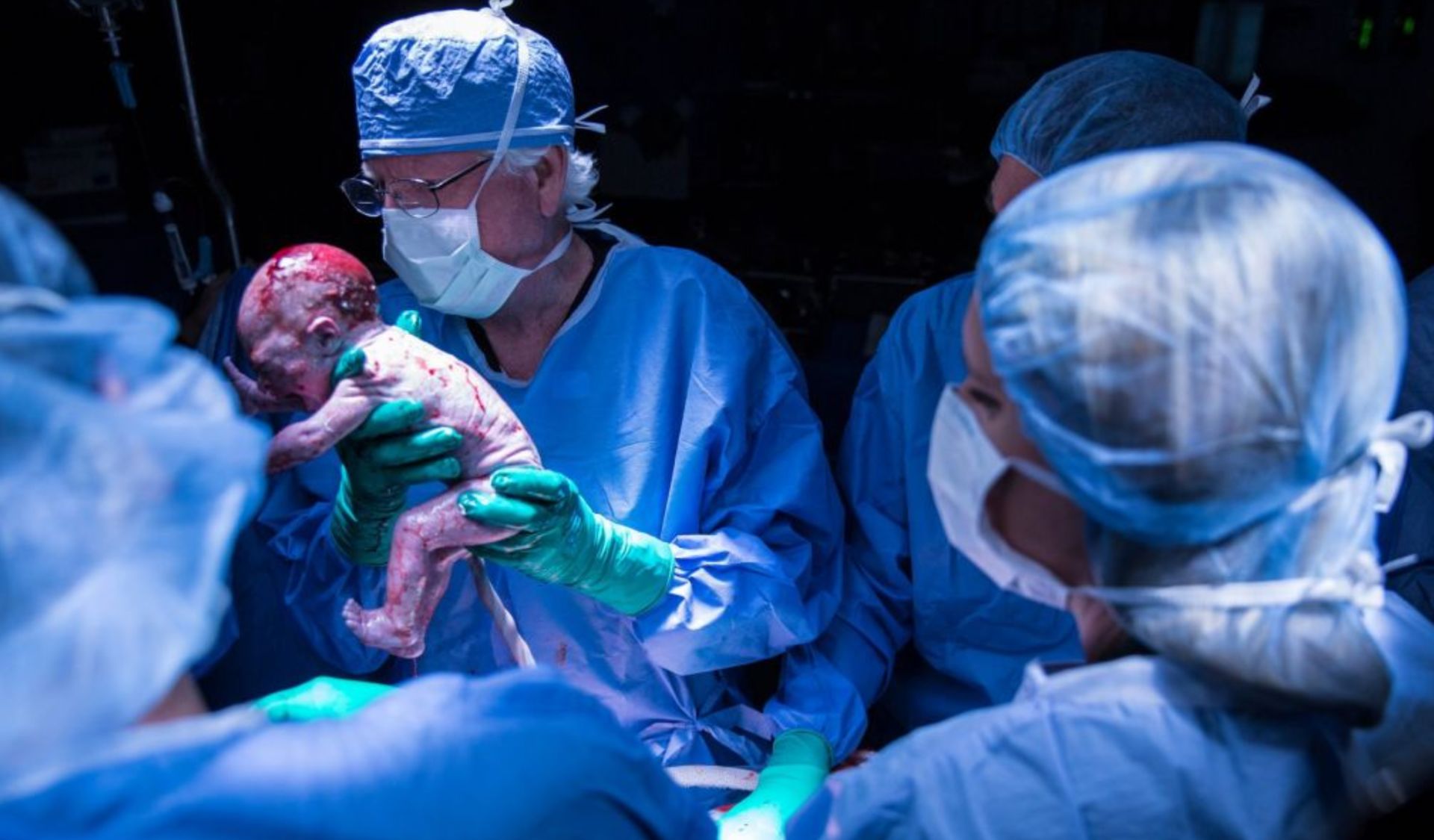 中国首例子宫移植成功案例,全球首例男性子宫移植成功