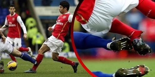 中甲再现断腿惨案,中甲赛场断腿