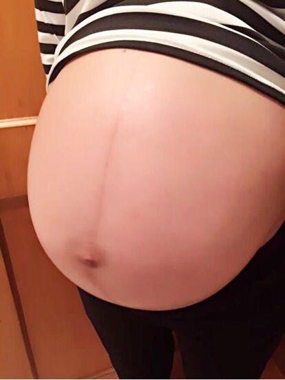 顺产胎儿入盆的形状 (孕晚期好顺产的肚型)