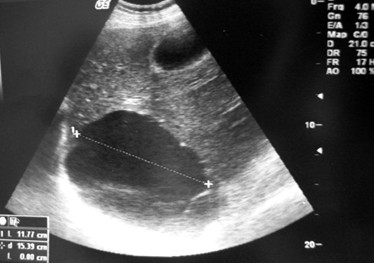 b超能看到宝宝形状吗,如何看b超单辨别婴儿长相