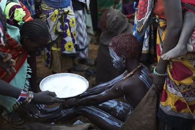 犹太割礼,浅谈缝合技术