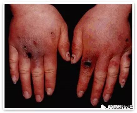 杏林微科普预防秋燥的方法,杏林科普有哪些小活动