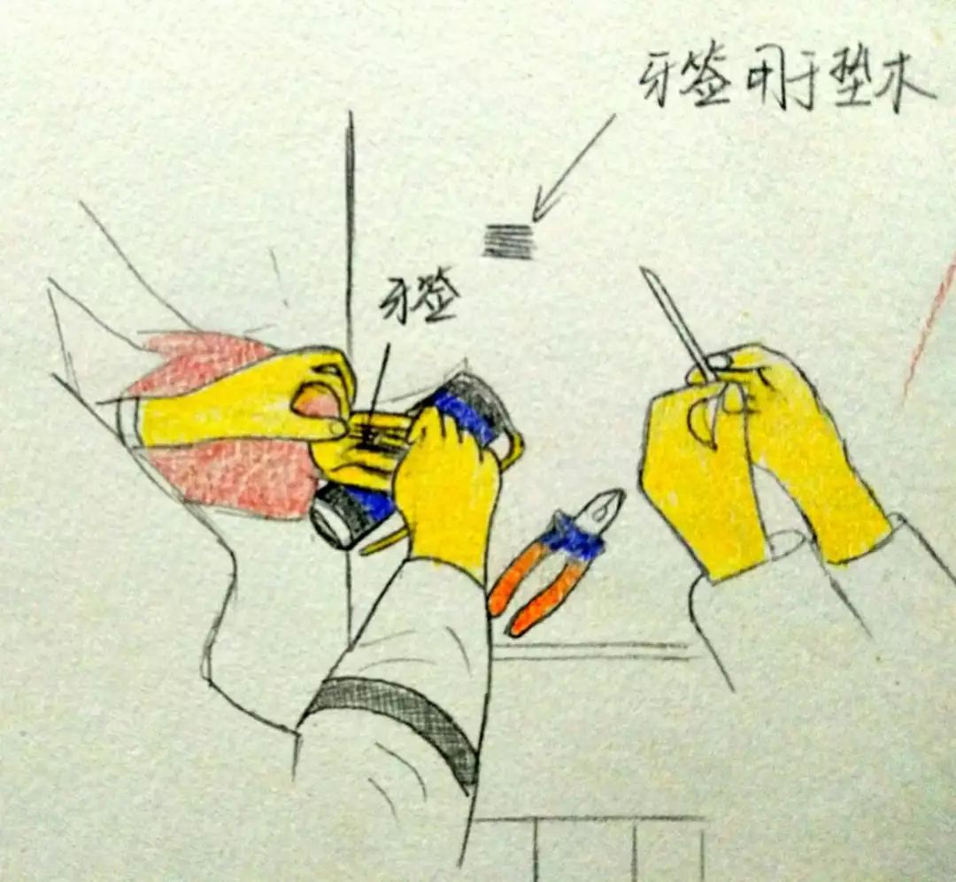 不会“摘除”戒指的帅蜀黍不是好消防员！