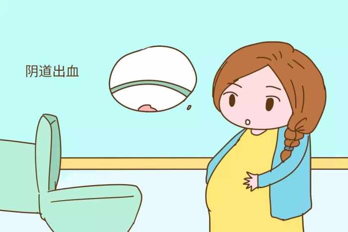 孕期一定要注意这些早产征兆,预防更重要!