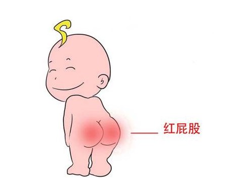 宝宝屁股干裂有什么好方法,宝宝屁屁淹了破皮出血了怎么办