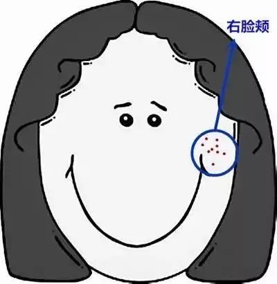 郑爽屏幕前貌美如花，幕后满脸痘花，明星都被坑的痘痘该怎么治？