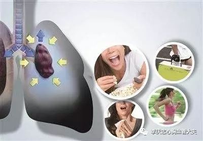 最常引起胸痛的是哪种肺癌,常见致命性胸痛有哪些