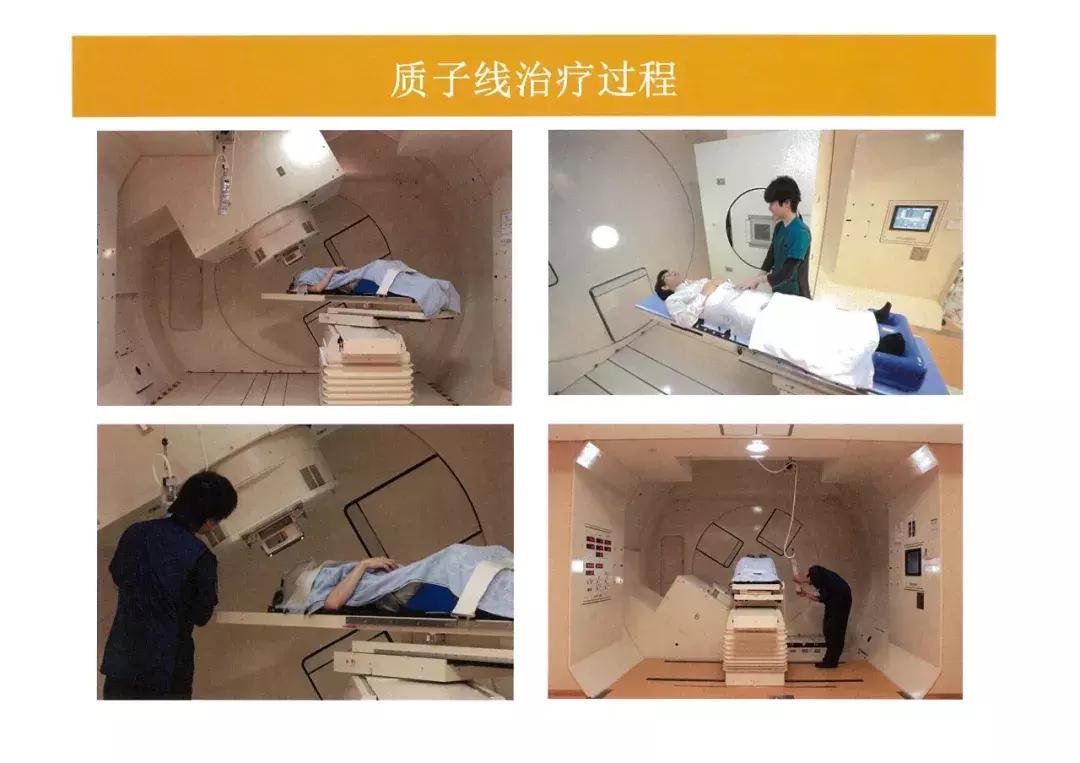 质子放疗中心安全距离,质子放疗介绍费