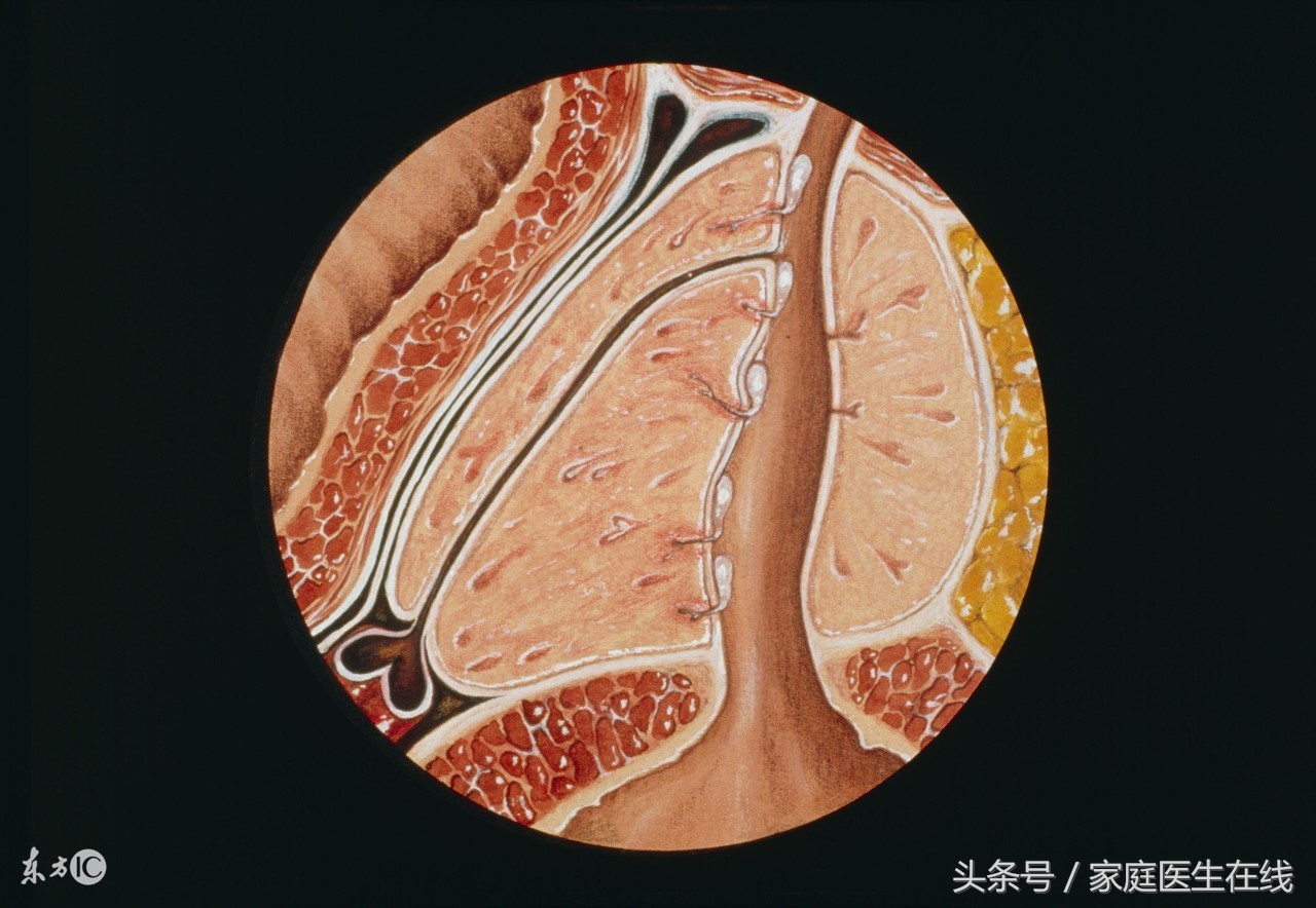 前列腺炎和前列腺增生适当运动,治疗前列腺的锻炼仪器