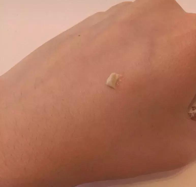 感觉脸上有痘痘但是不明显怎么办,脸上痘痘又爆发