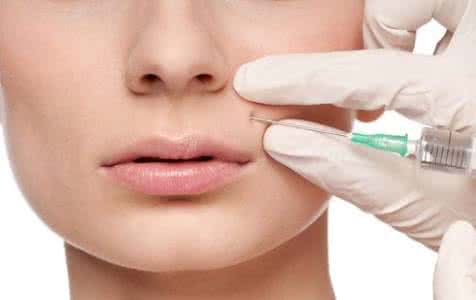 嘴角纹有什么办法去除,嘴角纹怎么消除吃什么食物好