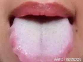 去眼袋的艾灸方法,孩子眼圈黑眼袋大怎么艾灸