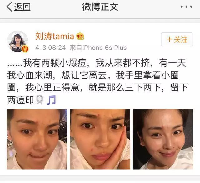 郑爽屏幕前貌美如花，幕后满脸痘花，明星都被坑的痘痘该怎么治？