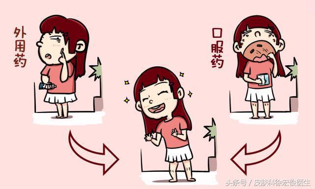 治疗痘痘的药剂,治疗痘痘的药能乱吃吗