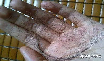 脱发案例丨菩叶毛囊赋活30天，生发效果立竿见影！
