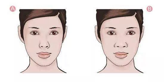 「爱美」双眼之间“一片荒芜”,鼻子一塌毁所有啊!